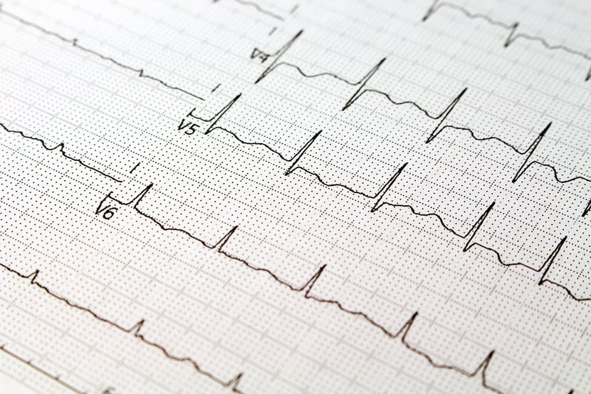 EKG paper